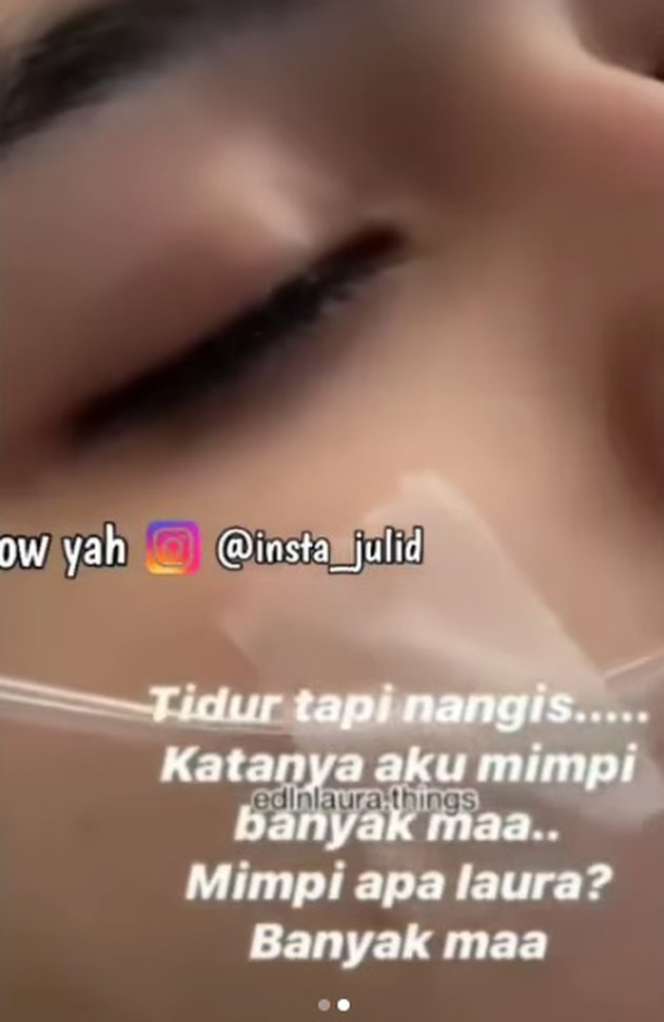 Potret Laura Anna Menangis dalam Tidurnya Usai Kecelakaan