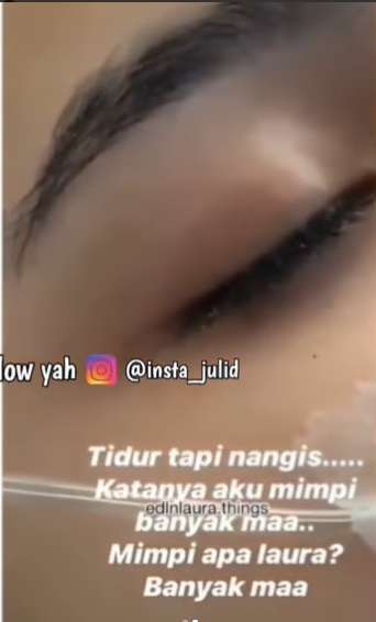 Potret Laura Anna Menangis dalam Tidurnya Usai Kecelakaan