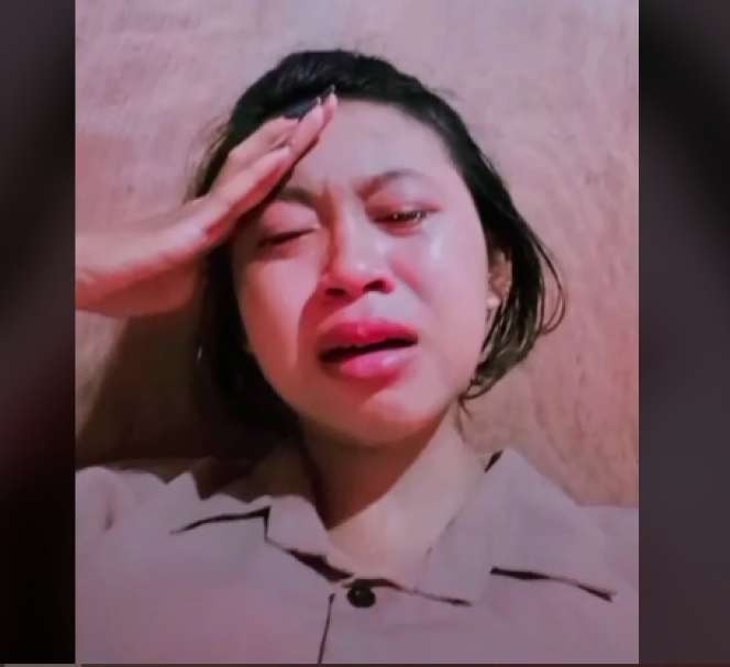 Takut Dimarahi Orang Tua, Cewek Ini Digigit King Kobra Hanya Diplaster, Kini Tubuhnya Membiru Lihat Potretnya!