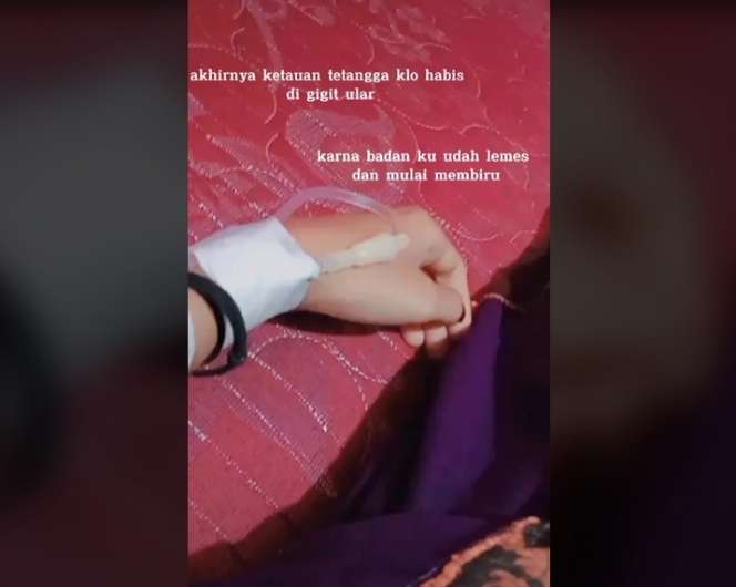 Takut Dimarahi Orang Tua, Cewek Ini Digigit King Kobra Hanya Diplaster, Kini Tubuhnya Membiru Lihat Potretnya!
