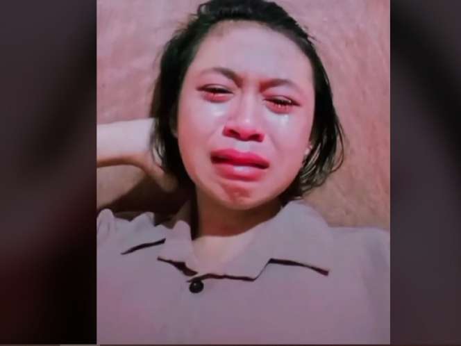 Takut Dimarahi Orang Tua, Cewek Ini Digigit King Kobra Hanya Diplaster, Kini Tubuhnya Membiru Lihat Potretnya!