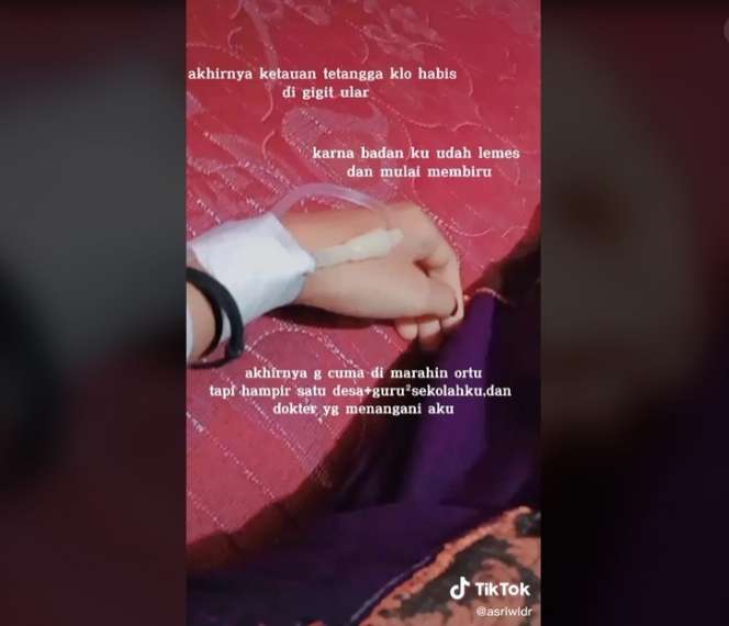 Takut Dimarahi Orang Tua, Cewek Ini Digigit King Kobra Hanya Diplaster, Kini Tubuhnya Membiru Lihat Potretnya!