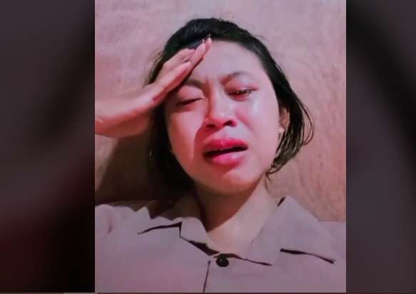 Takut Dimarahi Orang Tua, Cewek Ini Digigit King Kobra Hanya Diplaster, Kini Tubuhnya Membiru Lihat Potretnya!