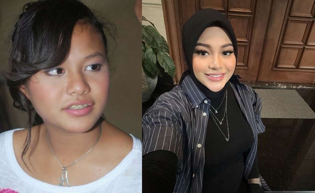 10 Potret Artis Sebelum VS Sesudah Mengenal Perawatan, Cita Citata Beda Banget!