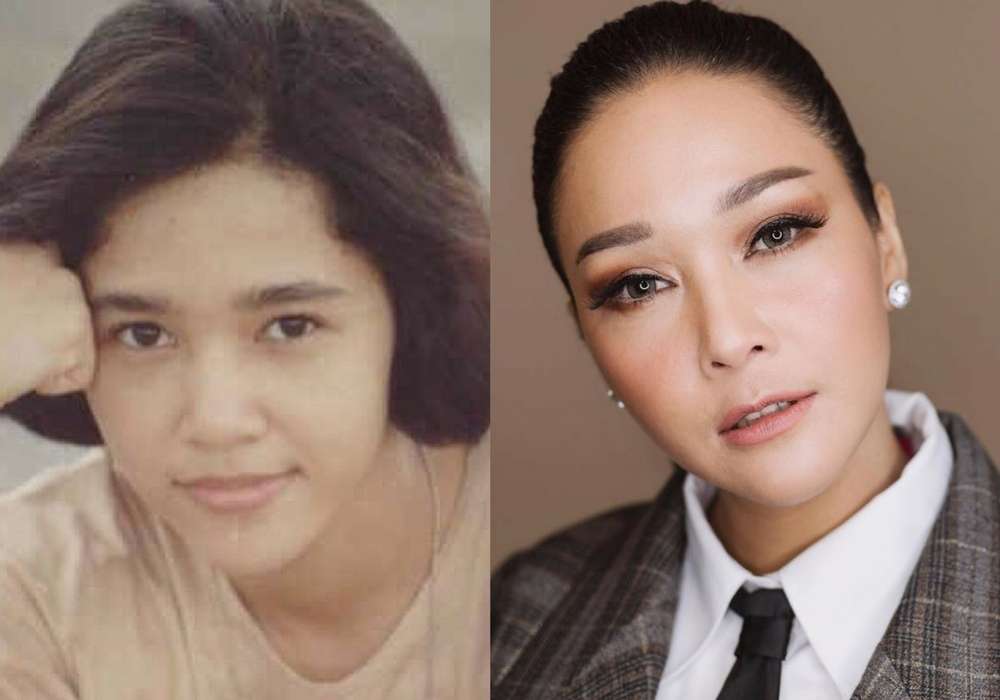 10 Potret Artis Sebelum VS Sesudah Mengenal Perawatan, Cita Citata Beda Banget!