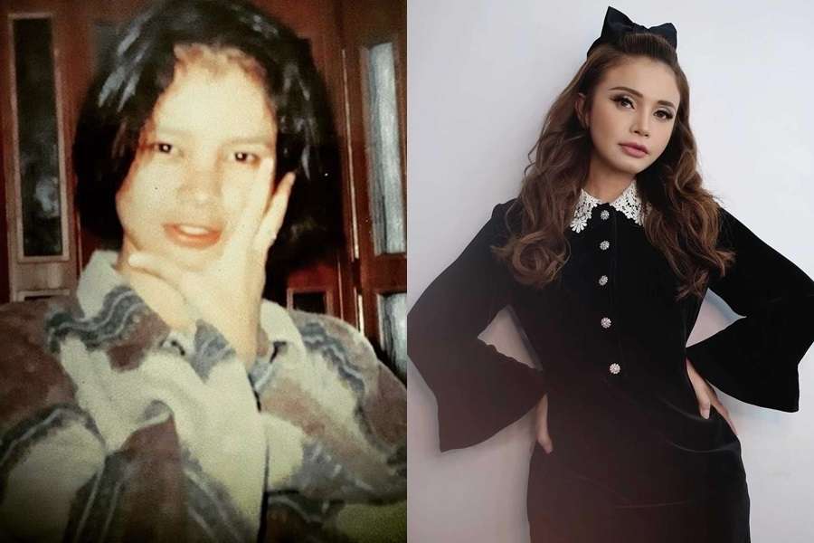 10 Potret Artis Sebelum VS Sesudah Mengenal Perawatan, Cita Citata Beda Banget!