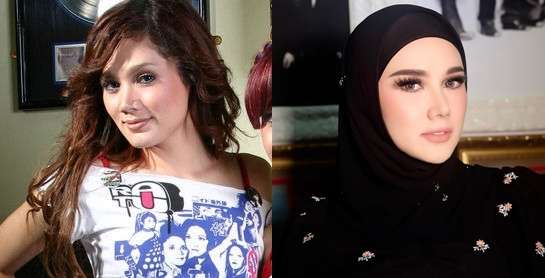 10 Potret Artis Sebelum VS Sesudah Mengenal Perawatan, Cita Citata Beda Banget!