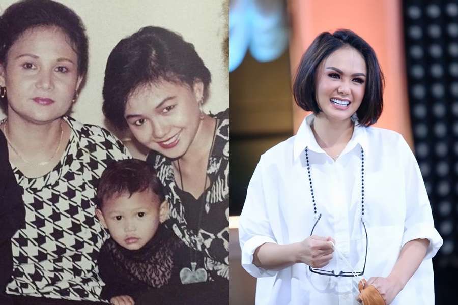 10 Potret Artis Sebelum VS Sesudah Mengenal Perawatan, Cita Citata Beda Banget!