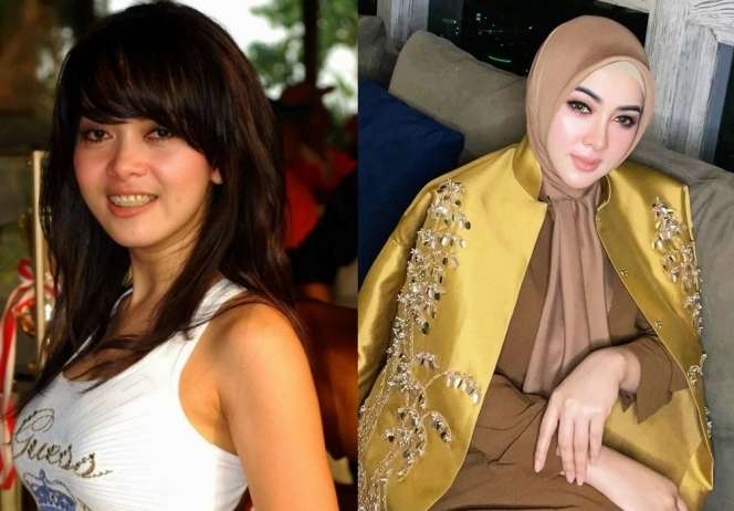 10 Potret Artis Sebelum VS Sesudah Mengenal Perawatan, Cita Citata Beda Banget!