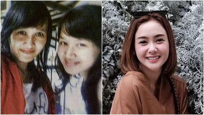 10 Potret Artis Sebelum VS Sesudah Mengenal Perawatan, Cita Citata Beda Banget!
