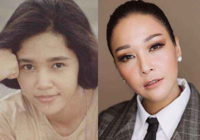 10 Potret Artis Sebelum VS Sesudah Mengenal Perawatan, Cita Citata Beda Banget!