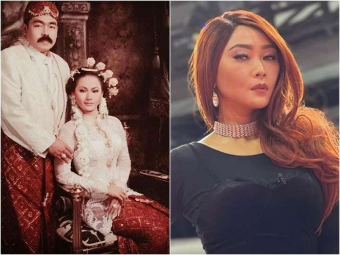 8 Potret Inul Daratista Dulu VS Sekarang, Perubahannya Bikin Pangling!