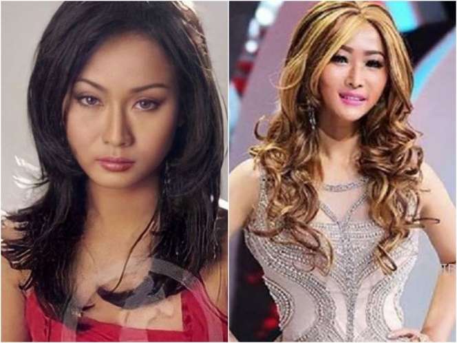 8 Potret Inul Daratista Dulu VS Sekarang, Perubahannya Bikin Pangling!