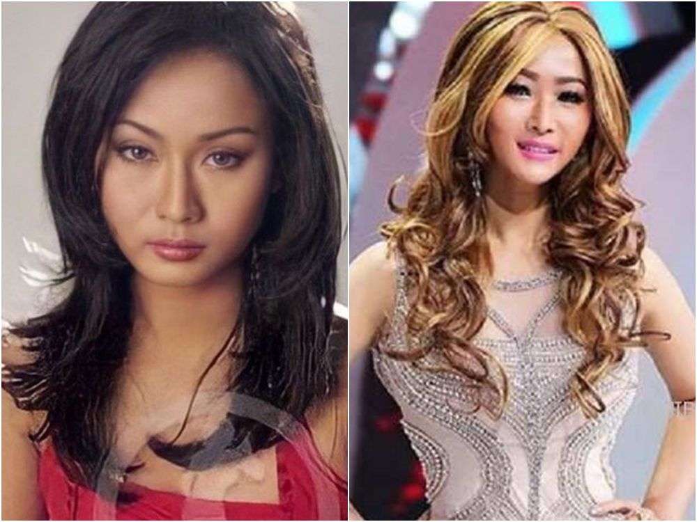 8 Potret Inul Daratista Dulu VS Sekarang, Perubahannya Bikin Pangling!