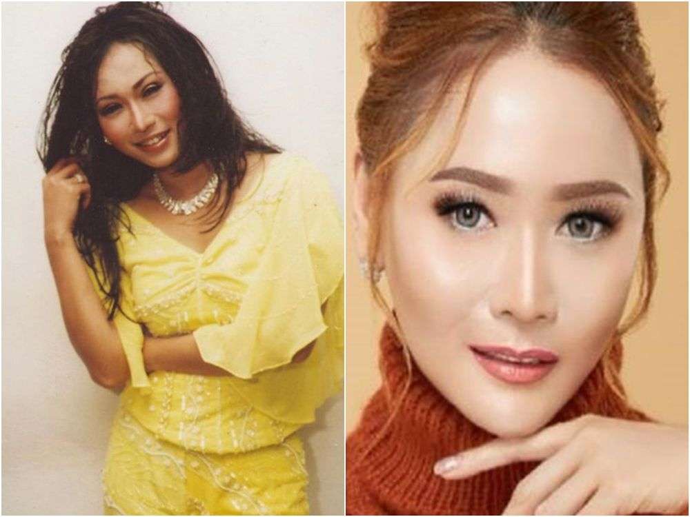 8 Potret Inul Daratista Dulu VS Sekarang, Perubahannya Bikin Pangling!