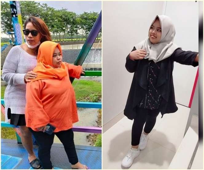 7 Potret Dulu VS Sekarang Kekeyi, Wajah Tirusnya Curi Perhatian!