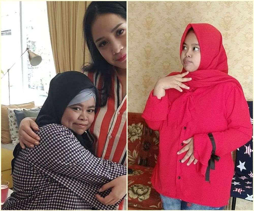7 Potret Dulu VS Sekarang Kekeyi, Wajah Tirusnya Curi Perhatian!