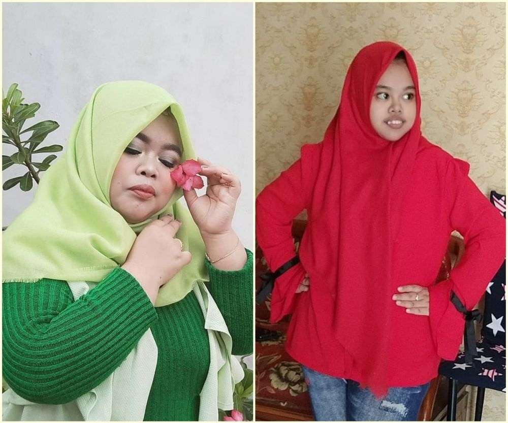 7 Potret Dulu VS Sekarang Kekeyi, Wajah Tirusnya Curi Perhatian!