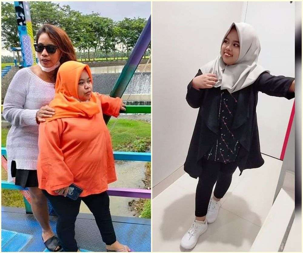 7 Potret Dulu VS Sekarang Kekeyi, Wajah Tirusnya Curi Perhatian!