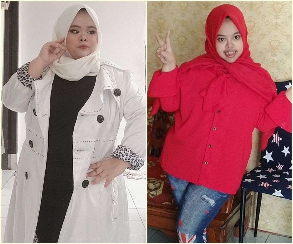 7 Potret Dulu VS Sekarang Kekeyi, Wajah Tirusnya Curi Perhatian!