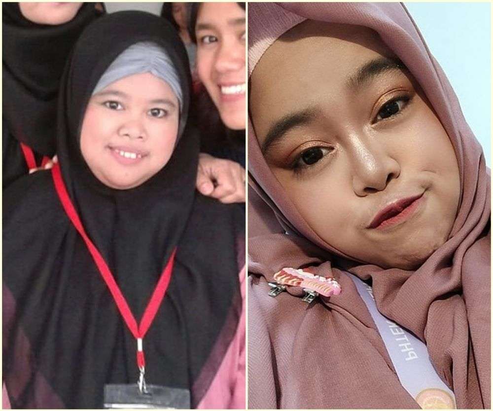 7 Potret Dulu VS Sekarang Kekeyi, Wajah Tirusnya Curi Perhatian!