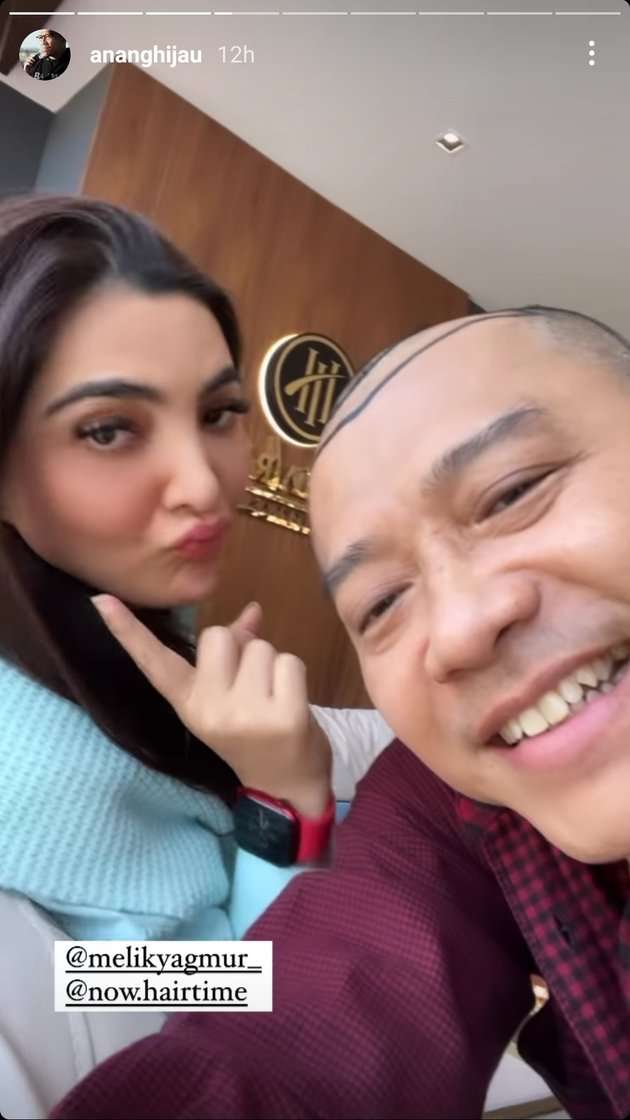 Potret Anang Hermansyah Pamer Kepala Botak Untuk Tanam Rambut, Deg-Degan Nunggu Hasilnya!
