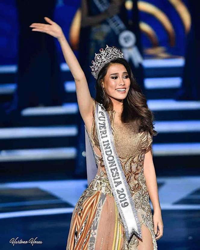 Miranda 'Layangan Putus' Ternyata Eks Putri Indonesia, Lihat 10 Foto Kesehariannya, Cantik Abis!