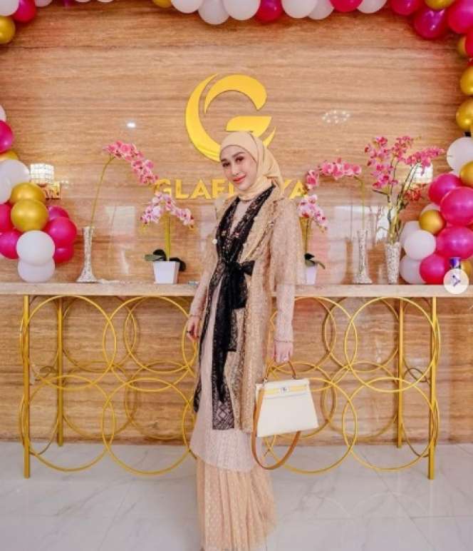 8 Potret Dokter Reza Gladys Kakak Ipar Siti Badriah, Tubuh Langsingnya Bikin Salfok!