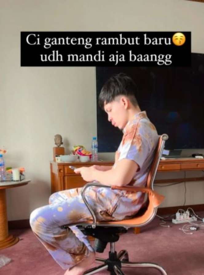 Atta Halilintar Lakukan Transplantasi Rambut, Hasilnya Bikin Aurel Makin Gemes!