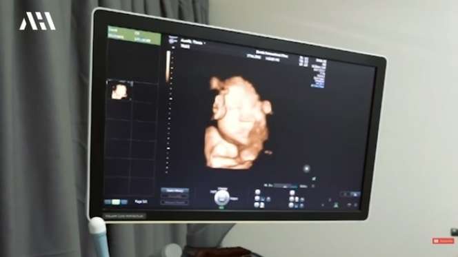 Diperkirakan Lahir di Tanggal Cantik Aurel Hermansyah Rutin Periksa Kandungan, Lihat 8 Potretnya!