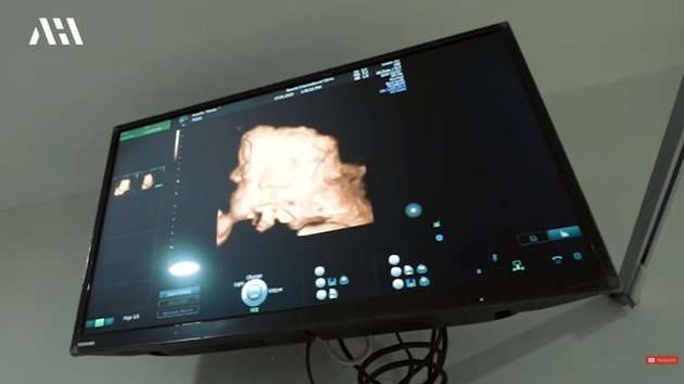 Diperkirakan Lahir di Tanggal Cantik Aurel Hermansyah Rutin Periksa Kandungan, Lihat 8 Potretnya!