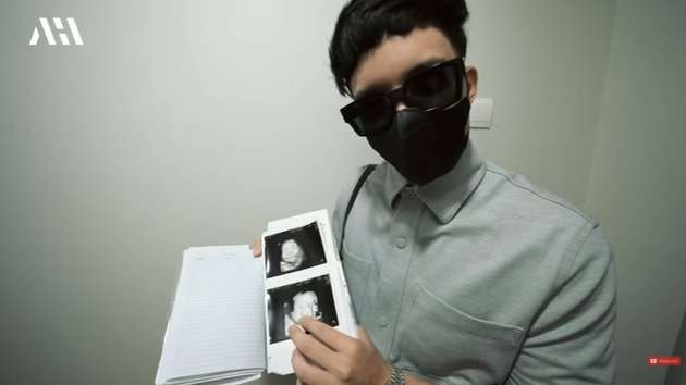 Diperkirakan Lahir di Tanggal Cantik Aurel Hermansyah Rutin Periksa Kandungan, Lihat 8 Potretnya!
