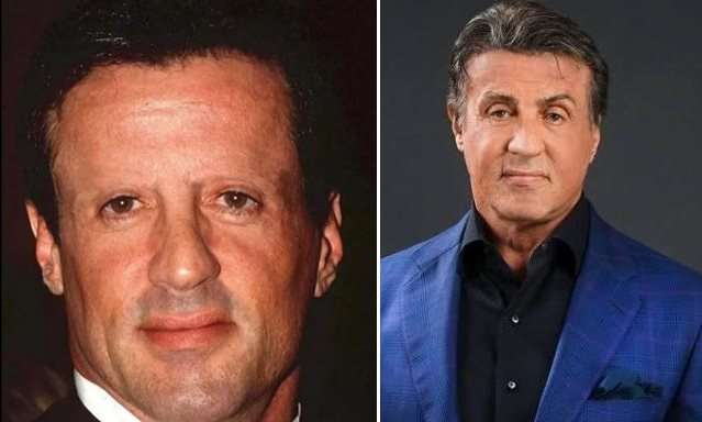 6 Potret Artis Sebelum Vs Sesudah Transplantasi Rambut, Atta Halilintar Makin Keren & Ganteng Abis!