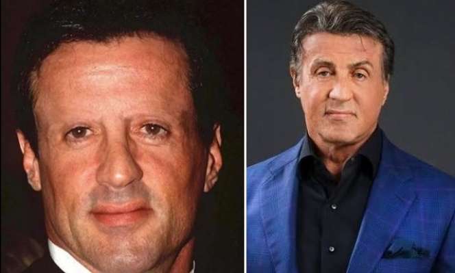 6 Potret Artis Sebelum Vs Sesudah Transplantasi Rambut, Atta Halilintar Makin Keren & Ganteng Abis!