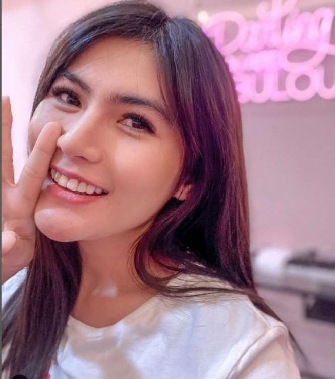6 Artis Cantik yang Pernah Gagal Oplas, Jessica Iskandar Sampai `Alergi` Matahari!