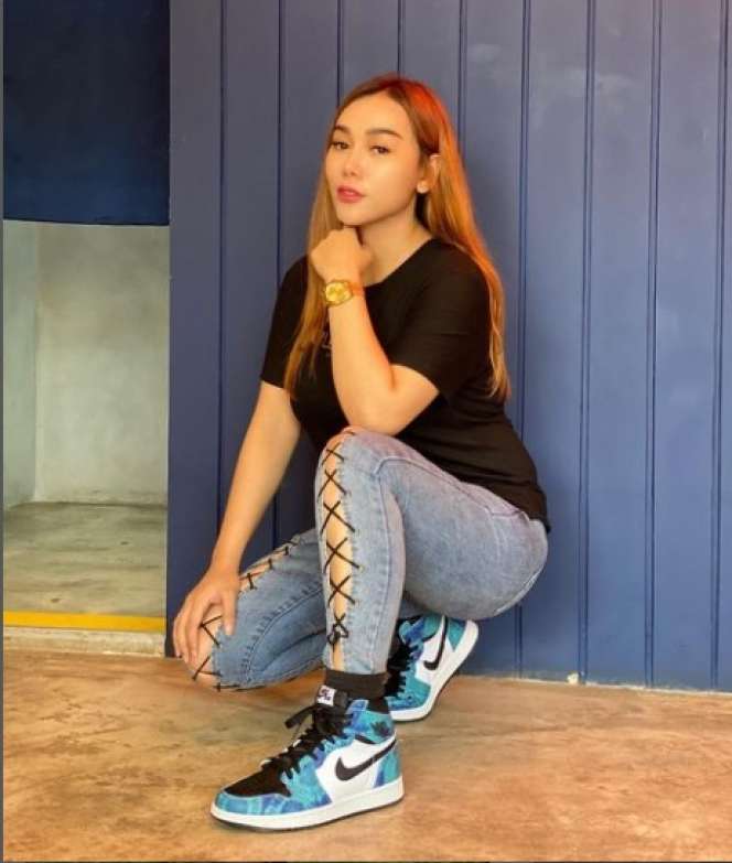 6 Artis Cantik yang Pernah Gagal Oplas, Jessica Iskandar Sampai `Alergi` Matahari!