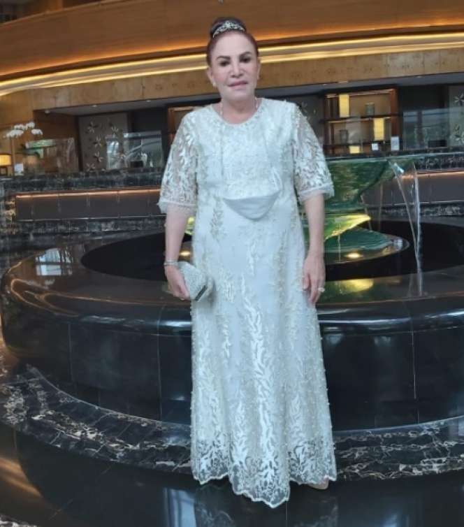 6 Artis Cantik yang Pernah Gagal Oplas, Jessica Iskandar Sampai `Alergi` Matahari!