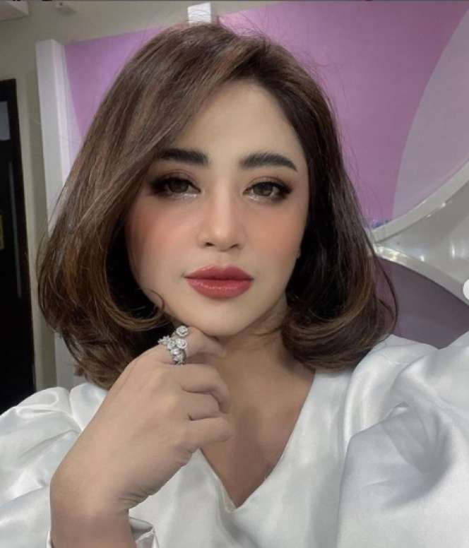7 Seleb Cantik yang Jalani Sulam Bibir, Siapa yang Hasilnya Sempurna?