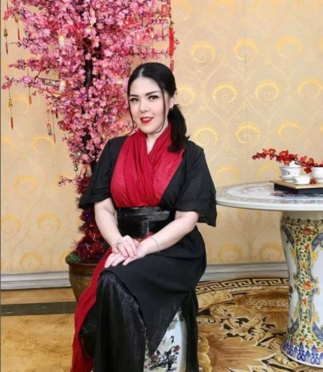 7 Seleb Cantik yang Jalani Sulam Bibir, Siapa yang Hasilnya Sempurna?