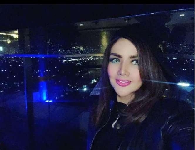 7 Seleb Cantik yang Jalani Sulam Bibir, Siapa yang Hasilnya Sempurna?