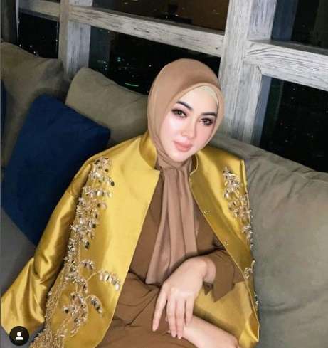 7 Seleb Cantik yang Jalani Sulam Bibir, Siapa yang Hasilnya Sempurna?
