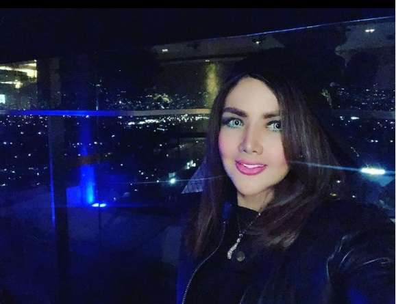 7 Seleb Cantik yang Jalani Sulam Bibir, Siapa yang Hasilnya Sempurna?