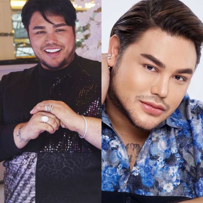 12 Potret Artis Sebelum Vs Sesudah Operasi Plastik, Dara Arafah Berubah Drastis!
