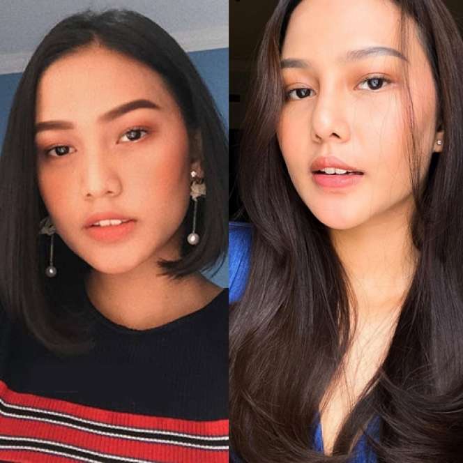 12 Potret Artis Sebelum Vs Sesudah Operasi Plastik, Dara Arafah Berubah Drastis!