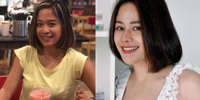 12 Potret Artis Sebelum Vs Sesudah Operasi Plastik, Dara Arafah Berubah Drastis!