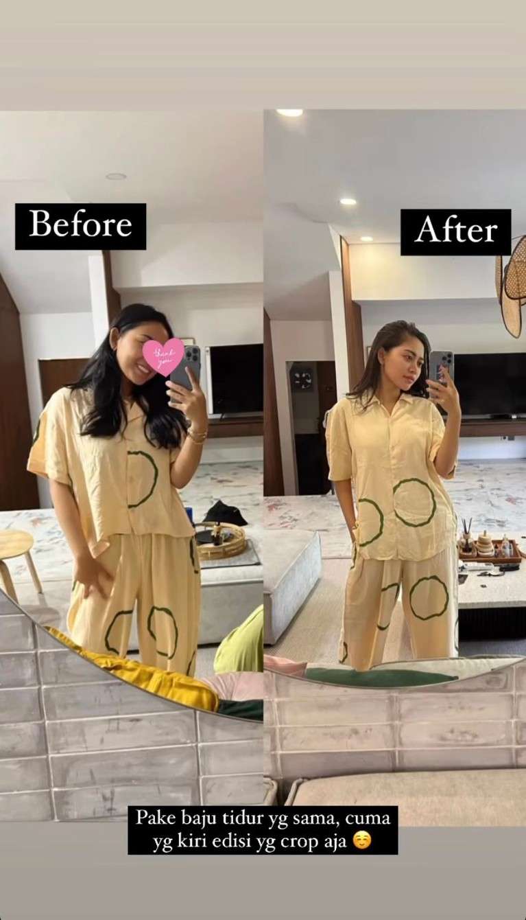 7 Potret Rachel Vennya Setelah Susut Bobot 10 Kg, Penampilan Terbaru Bikin Syok!