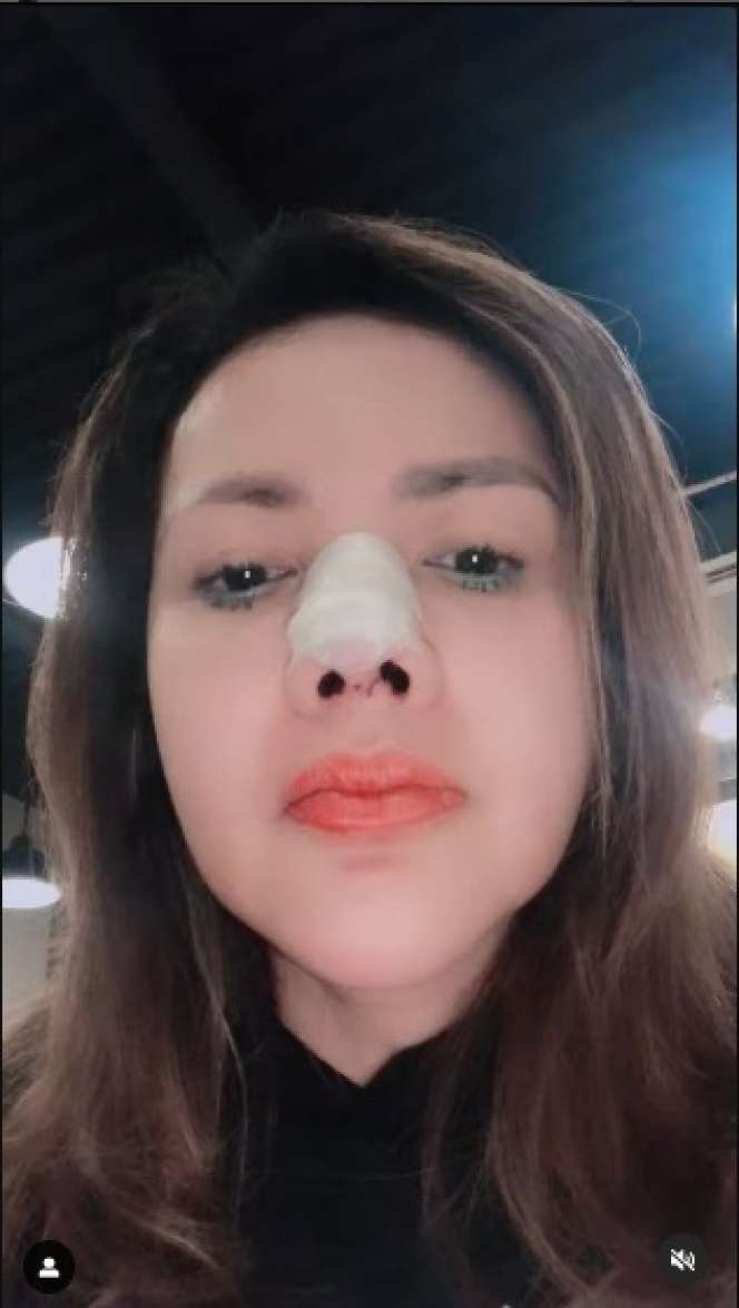 Demi Tampil Cantik Barbie Kumalasari Korbankan Tulang Telinganya!