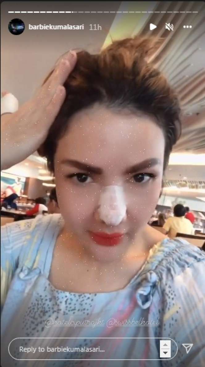Demi Tampil Cantik Barbie Kumalasari Korbankan Tulang Telinganya!