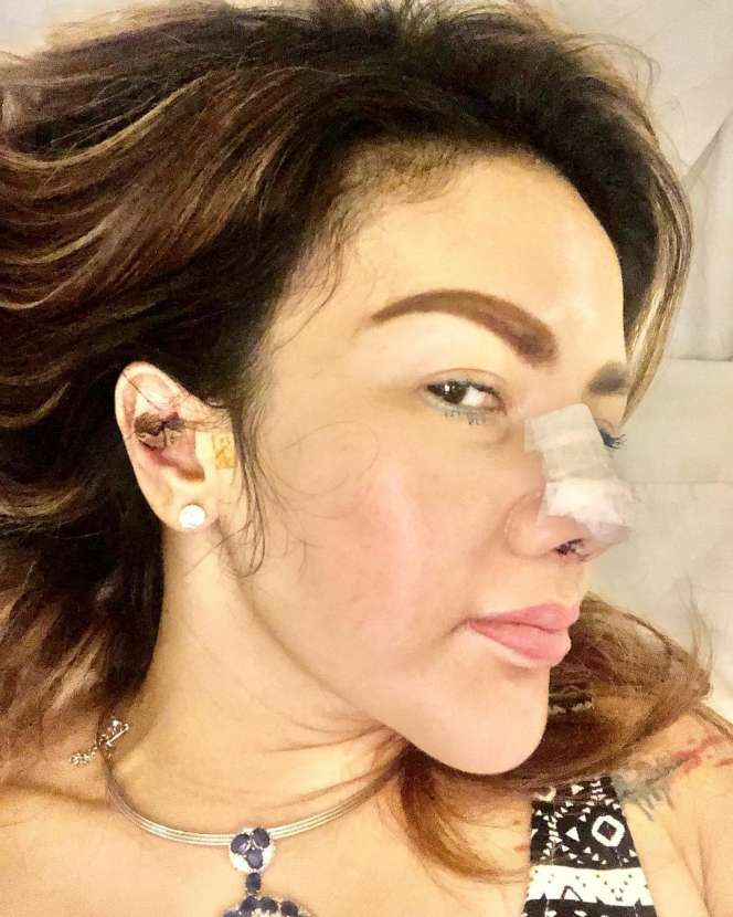 Demi Tampil Cantik Barbie Kumalasari Korbankan Tulang Telinganya!