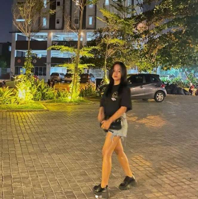 7 Perawatan Kecantikan Cimoy Montok, Filler Hidung Sampai Suntik Salmon DNA!